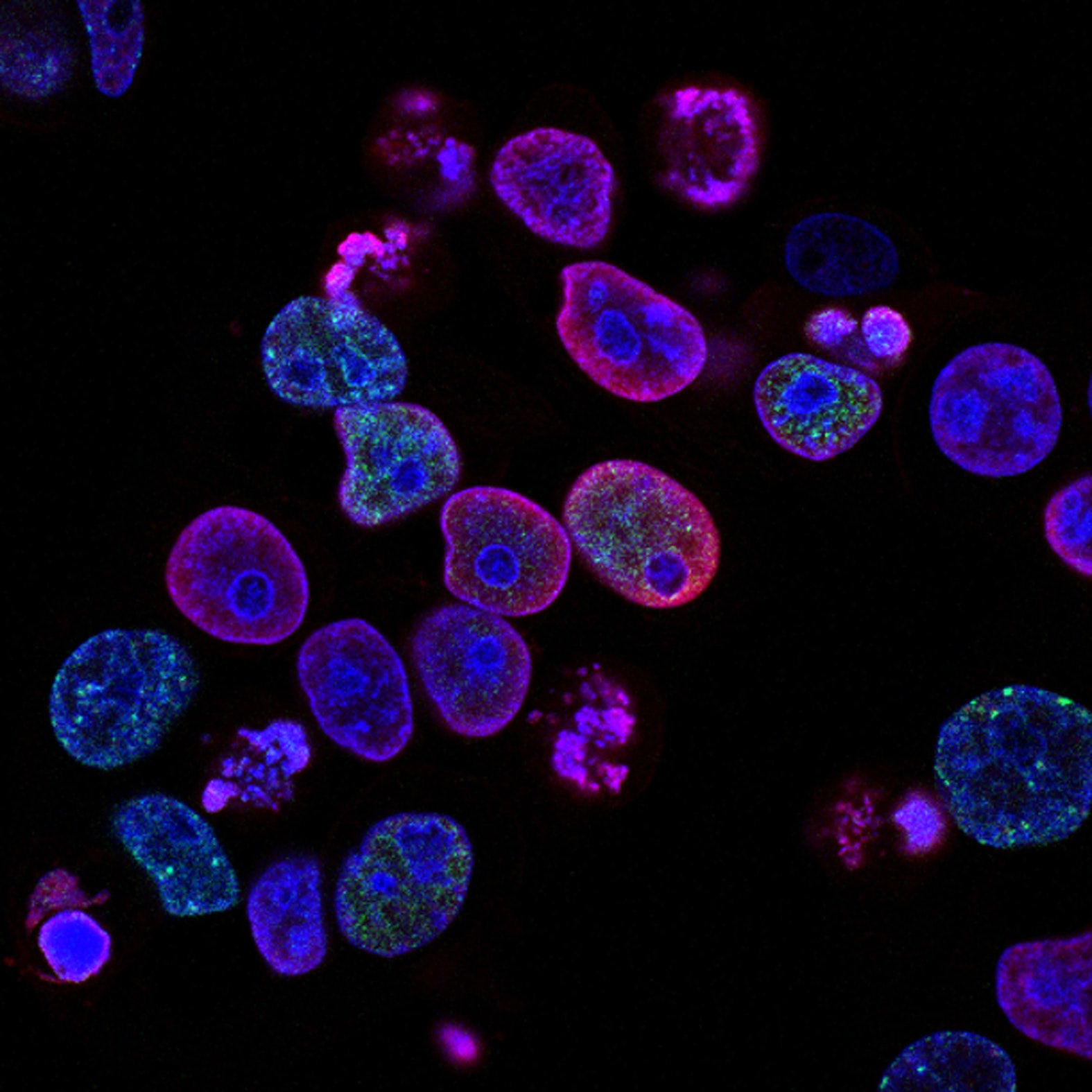 Investir dans les biotechnologies en bourse avec votre PEA-PME